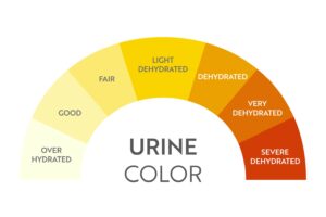 Dark Yellow Urine : Hidden Signs of Dehydration in Your Body