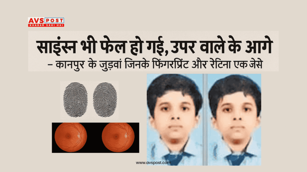 Science fail : साइंस भी फेल हो गई, ऊपर वाले के आगे – कानपुर के जुड़वां जिनके फिंगरप्रिंट और रेटिना एक जैसे