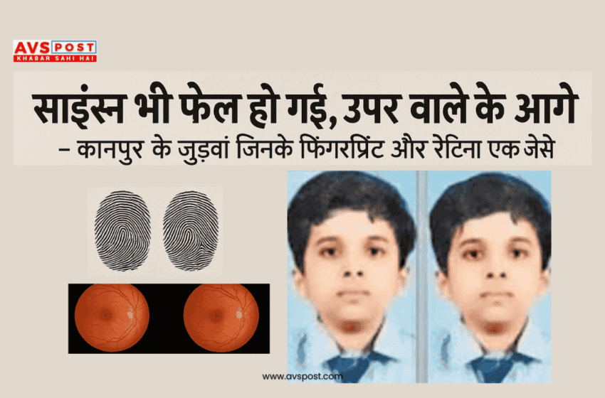 Science fail : साइंस भी फेल हो गई, ऊपर वाले के आगे – कानपुर के जुड़वां जिनके फिंगरप्रिंट और रेटिना एक जैसे